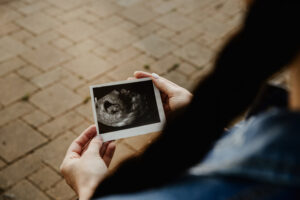 Why I Am Pro-Life